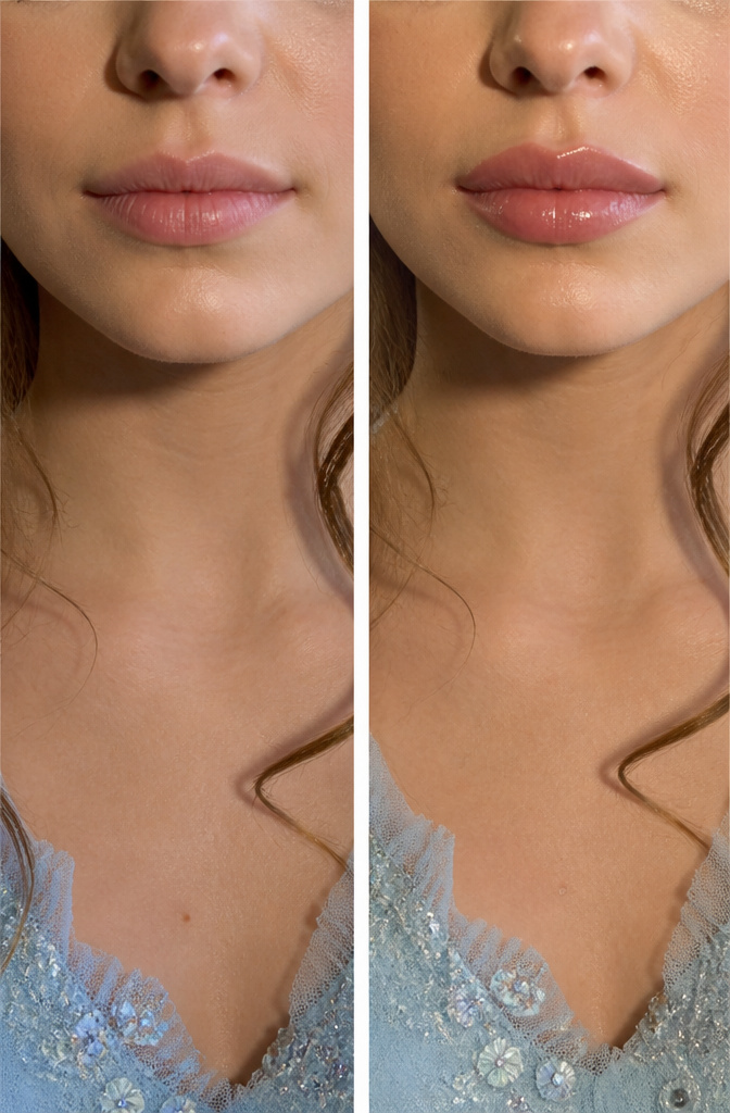 A close-up of a young woman's lips with a subtle overline in a prom setting.